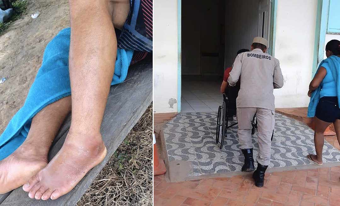 Bombeiros resgatam colono picado por cobra jararaca na zona rural de Sena Madureira