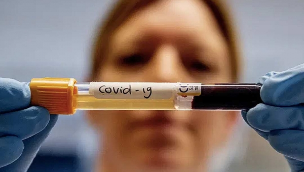 Número de infectados pelo coronavírus no Acre sobe de 25 para 34