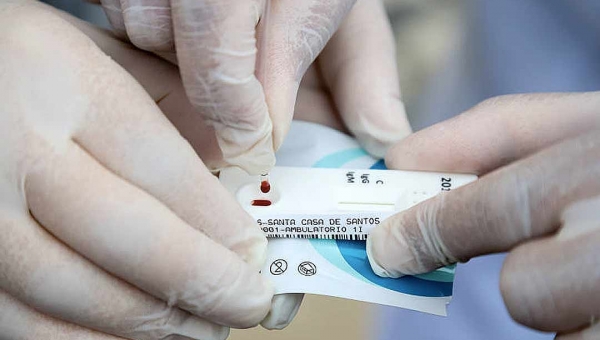 Prefeitura continua realizando testes rápidos da Covid-19 apenas para profissionais da saúde e da segurança