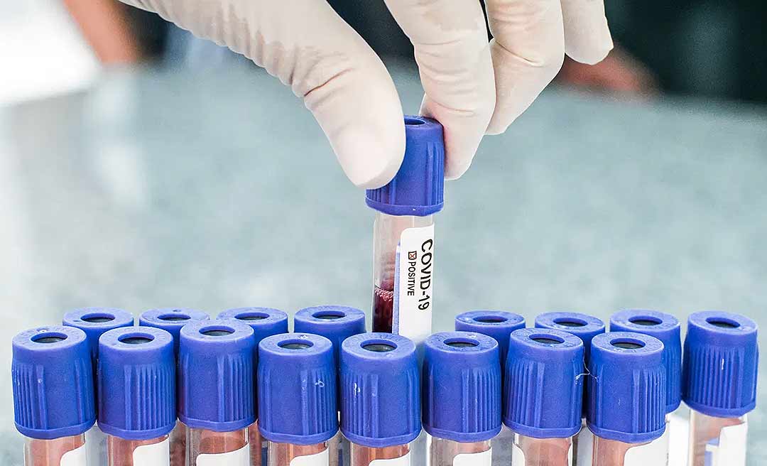 Acre registra mais de 9,5 mil casos de Covid-19, informa boletim parcial