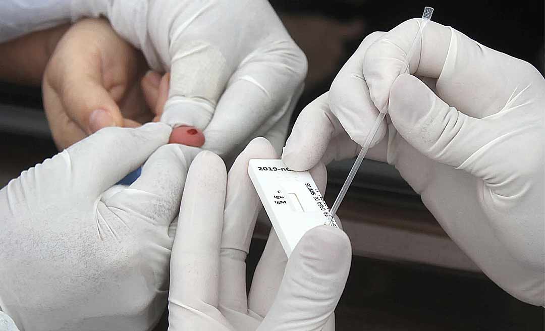 Sem incluir testes rápidos, Acre registra 64 novos casos de covid-19