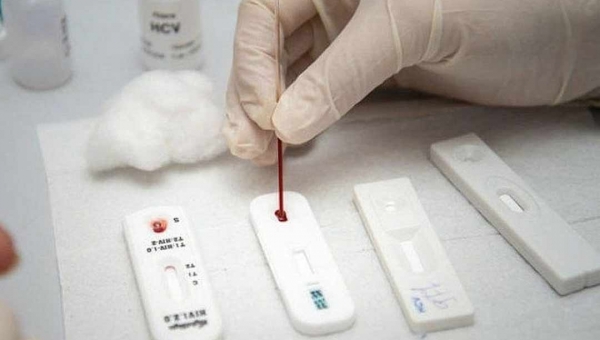 Prefeitura de Rio Branco faz cotação de preço para aquisição de testes rápidos para detecção de Anticorpos do novo Coronavírus