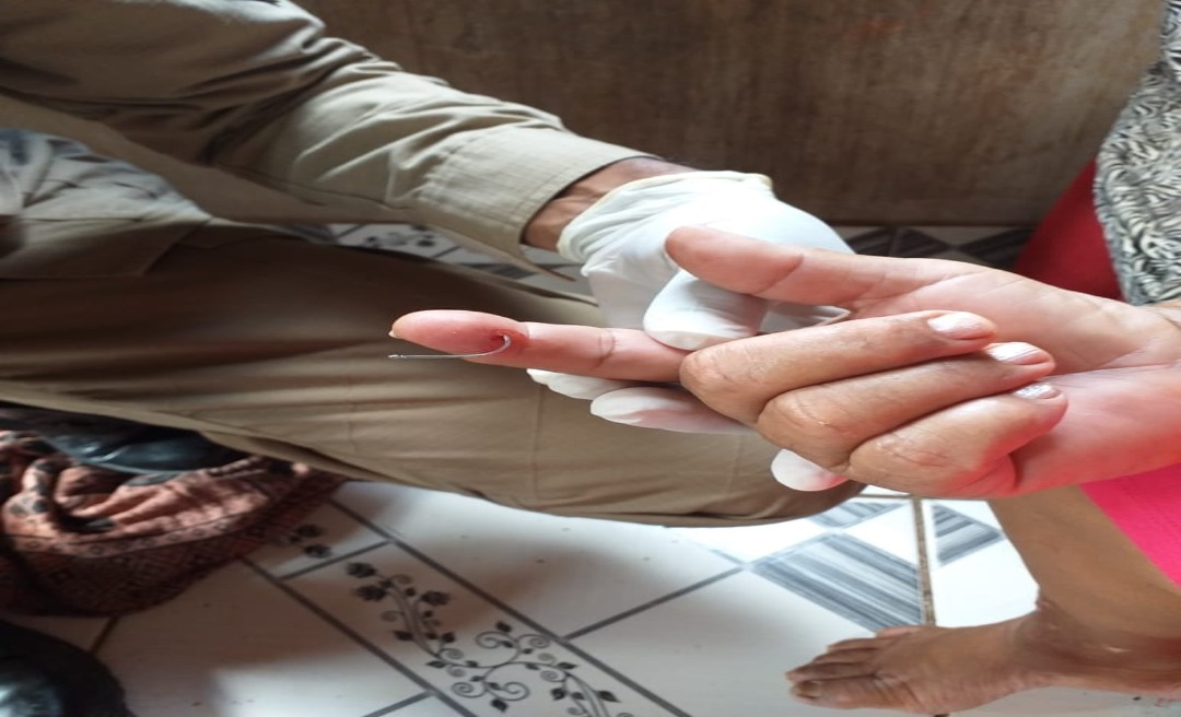 Mulher busca ajuda dos bombeiros para retirar anzol preso ao dedo no interior do Acre