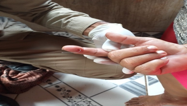 Mulher busca ajuda dos bombeiros para retirar anzol preso ao dedo no interior do Acre