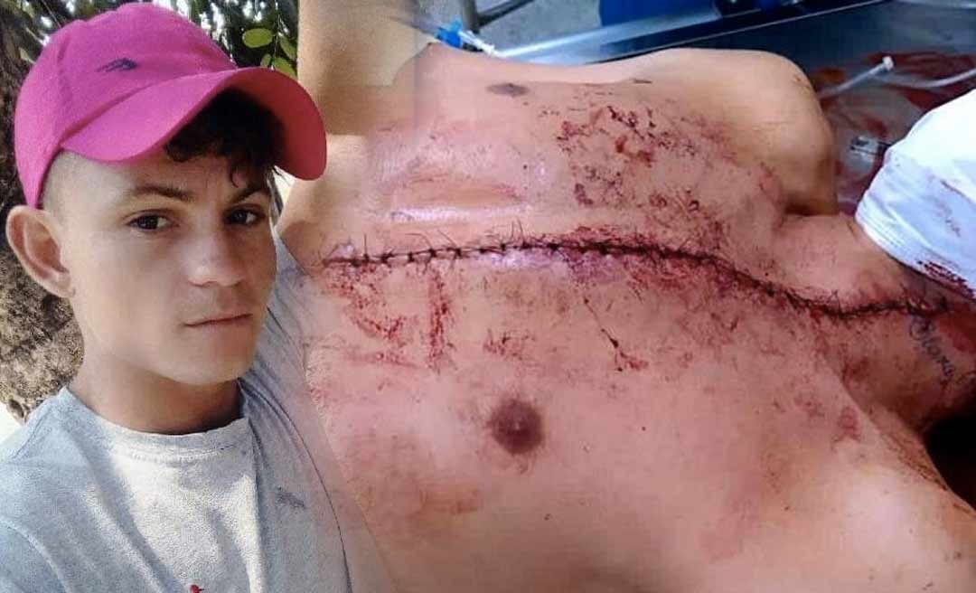 Ao ser recusado para dançar, homem tenta matar casal de jovens na zona rural de Brasiléia