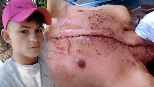 Ao ser recusado para dançar, homem tenta matar casal de jovens na zona rural de Brasiléia