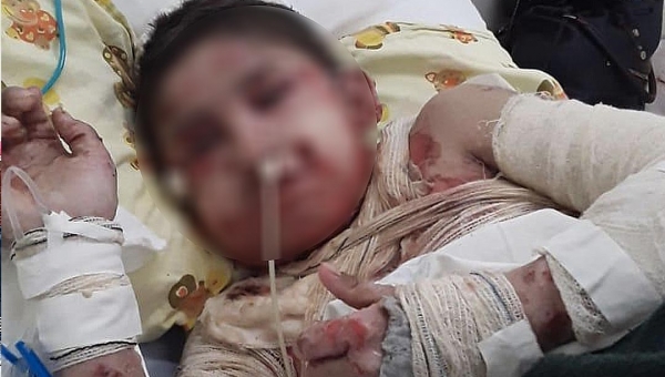 Adolescente boliviano morre em Rio Branco e Consulado nega translado do corpo 