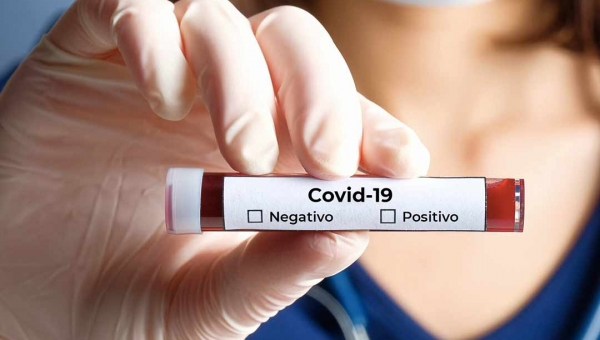 Covid-19: boletim da Sesacre não registrou morte nas últimas 24 horas