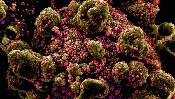 Mutação do coronavírus detectada no Reino Unido 'certamente já circula no Brasil', diz sanitarista