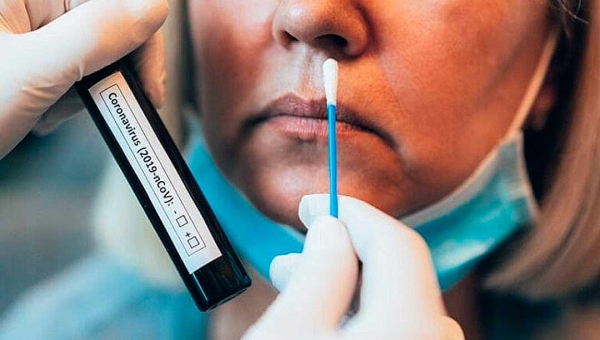 Acre registra quase 500 casos de covid-19 em 24 horas e mais quatro mortes