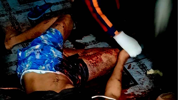 Criminosos invadem casa na Vila do Incra e atiram 8 vezes, dois disparos são na cabeça da vítima