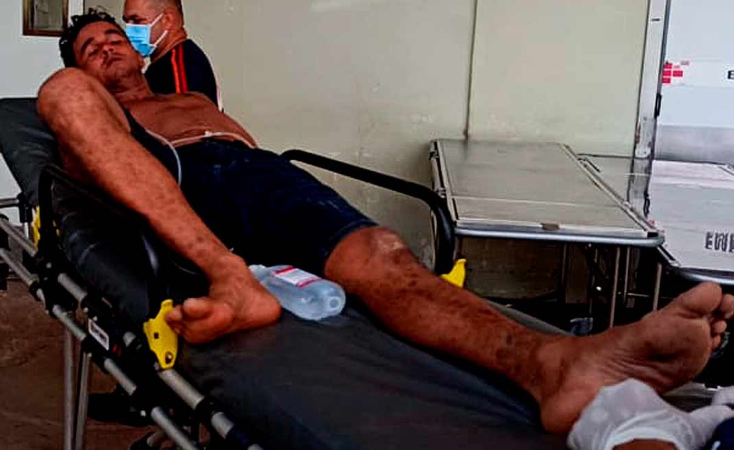 Viciado em drogas parte pra cima de policiais militares com uma faca e é baleado no Apolônio Sales