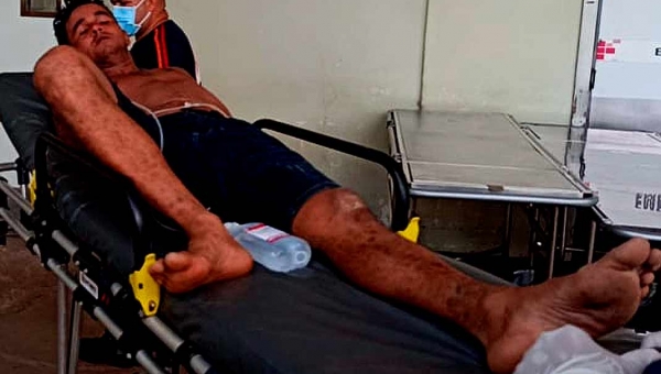 Viciado em drogas parte pra cima de policiais militares com uma faca e é baleado no Apolônio Sales