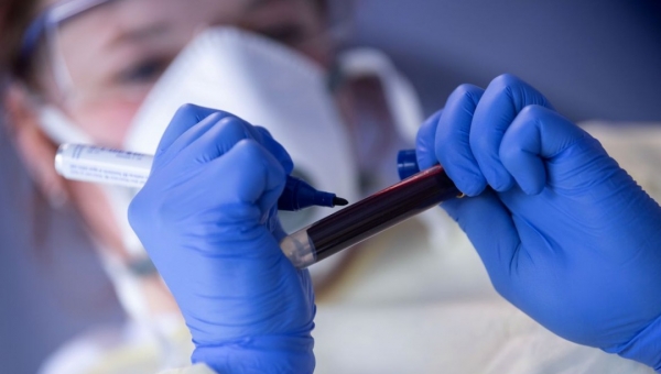 Covid-19: Acre registra sete mortes e mais 95 casos em 24 horas e chega perto de 1, 3 mil óbitos 