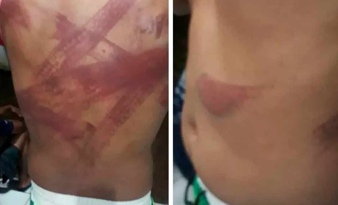 40 homens armados invadem e destroem sede da fazenda de dono da Uninorte e torturam trabalhadores em Rondônia