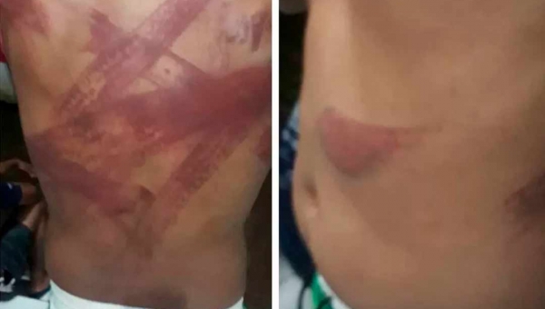 40 homens armados invadem e destroem sede da fazenda de dono da Uninorte e torturam trabalhadores em Rondônia