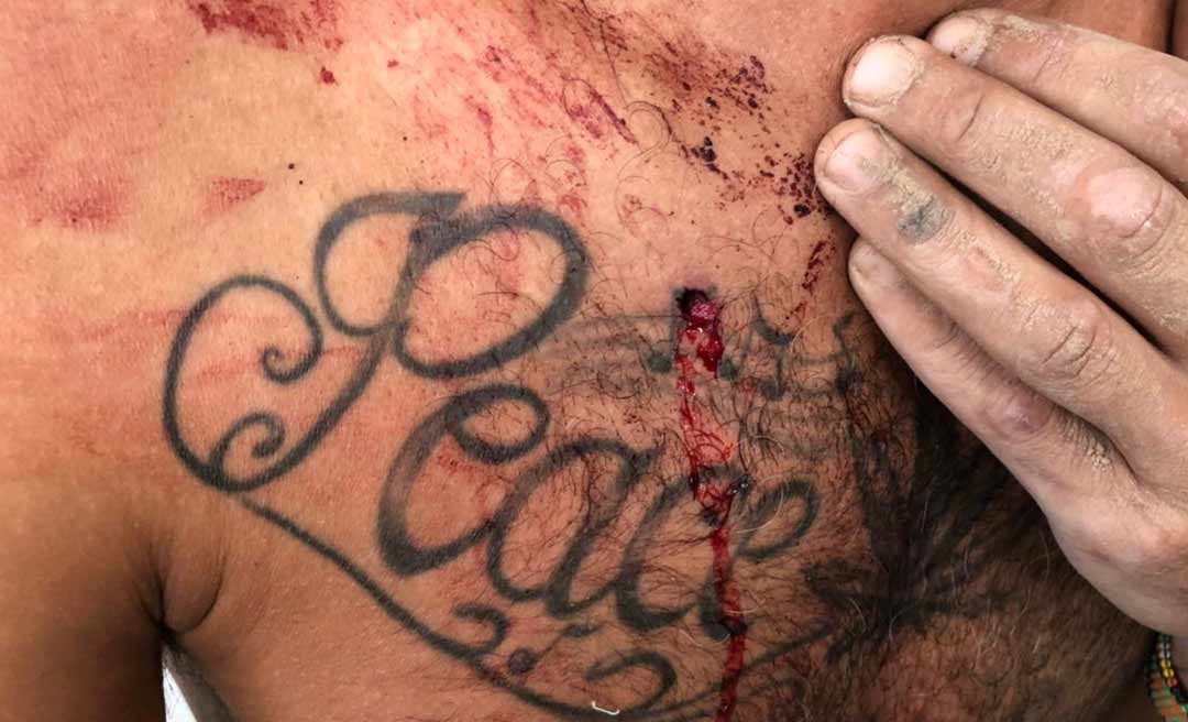 Homem é alvejado com tiro de pistola no rio Muru, na zona rural de Tarauacá