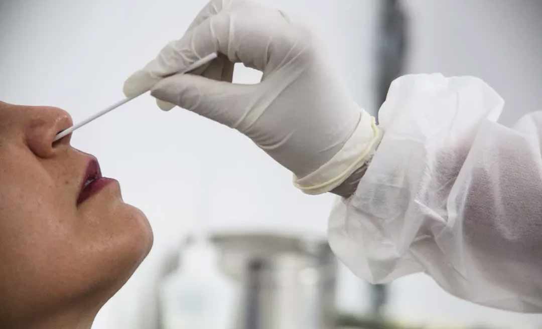 Covid-19: Acre registrou 117 casos e quatro mortes neste sábado