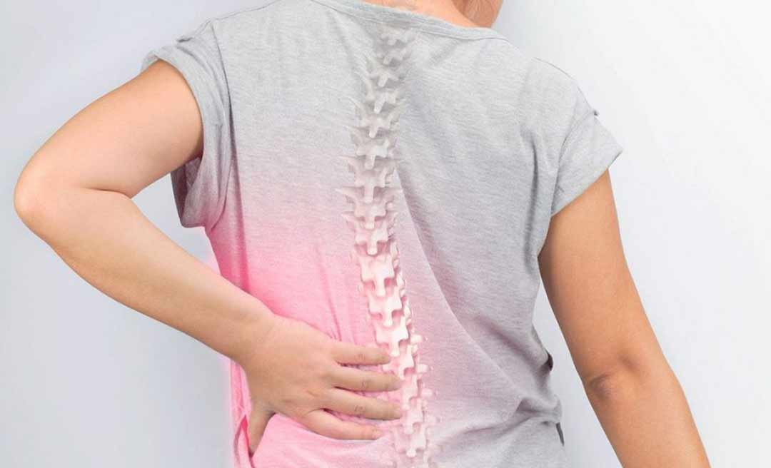 No Acre, enfermeira consegue na Justiça tratamento para osteoporose