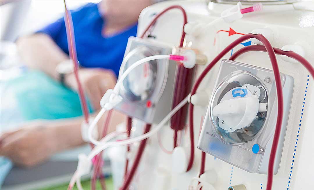 Renais crônicos, transplantados e pessoas com câncer terão prioridade em exames para detectar a covid