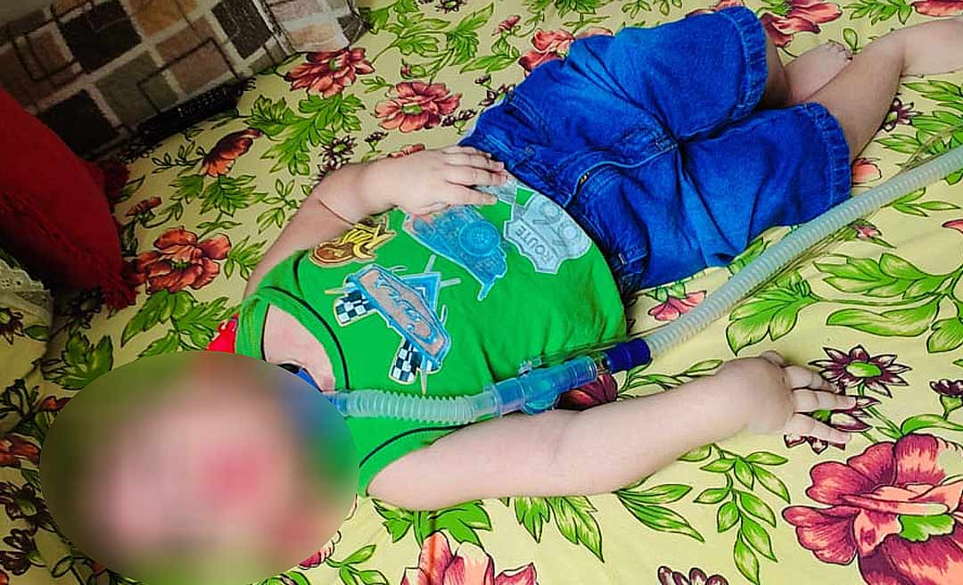 Mãe faz campanha para comprar cadeira de rodas para filho com encefalopatia crônica