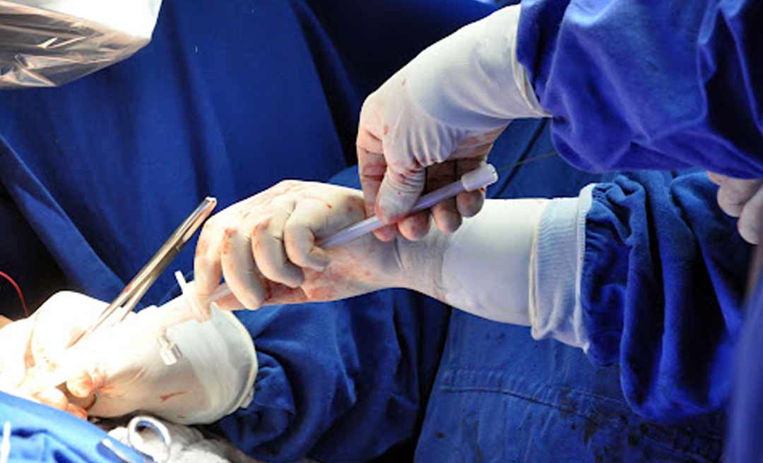 Estado é condenado a ressarcir despesas de cirurgia cardíaca em uma criança portadora da síndrome de down