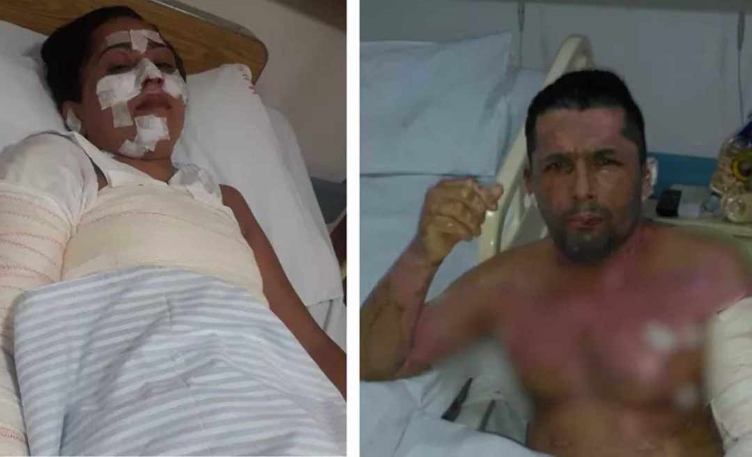 Família se queima ao usar álcool para cozinhar por falta de gás