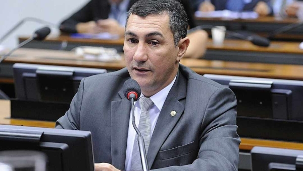 Jesus Sérgio solicita ao Ministério da Saúde distribuição gratuita de medicamentos para pacientes com Edema Macular Diabético