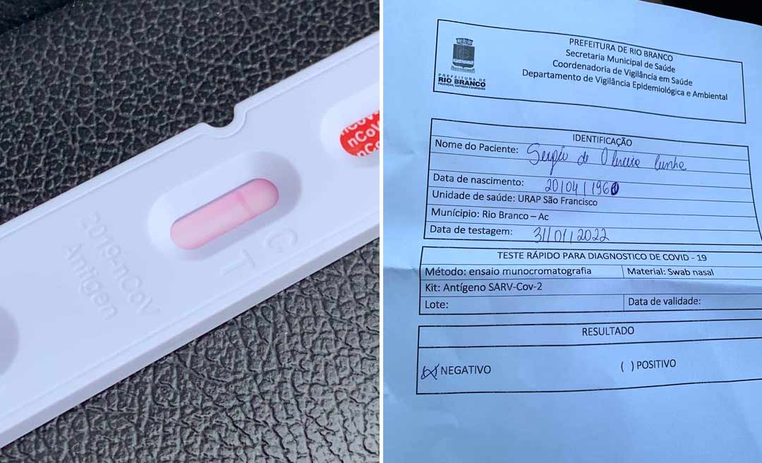 Petecão posta teste anticovid feito em posto do Município e é questionado: “Qual foi o milagre que foi feito para realizar seu teste?”