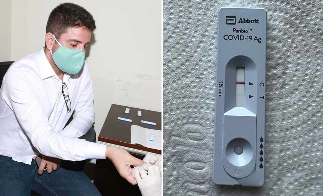 Governador Gladson Cameli testa positivo para covid-19 pela segunda vez