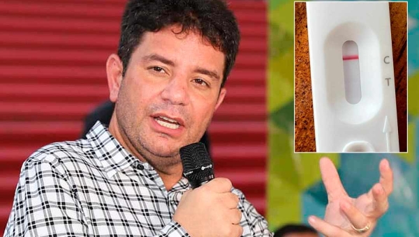 Após negativo em novo teste da covid, Gladson deixa isolamento; governador ficou só três dias em casa