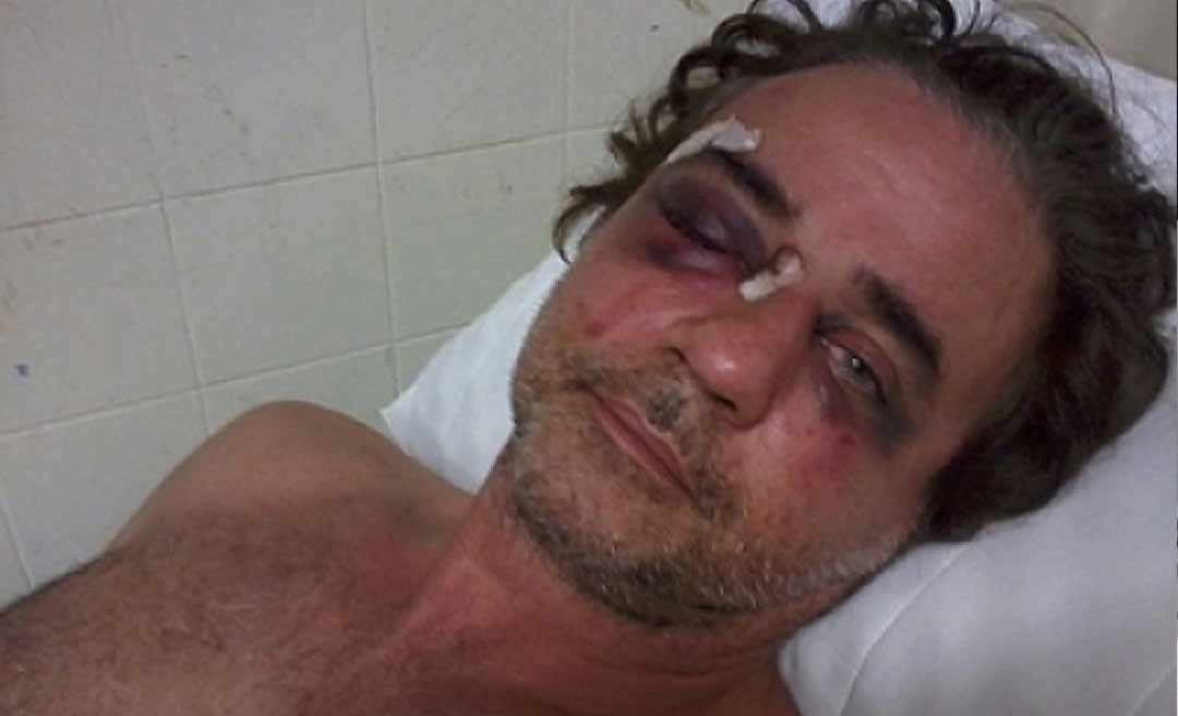 Turista espancado por Ícaro na Bahia grava vídeo pedindo condenação de Ícaro