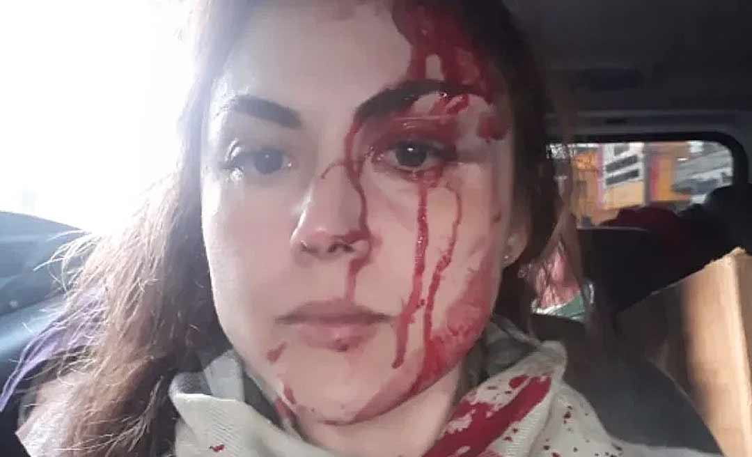 Polícia Civil prende procurador que agrediu chefe em ambiente de trabalho a socos e chutes