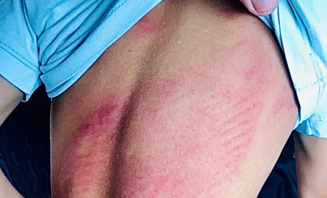 Mulher suspeita de lesionar gravemente os filhos de 7 e 3 anos volta a ser presa pela Polícia Civil em Feijó