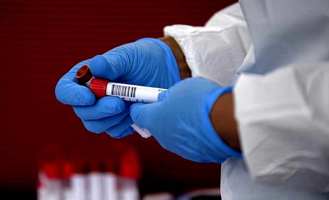 Acre registra 119 casos de covid-19 e uma morte nesta segunda-feira