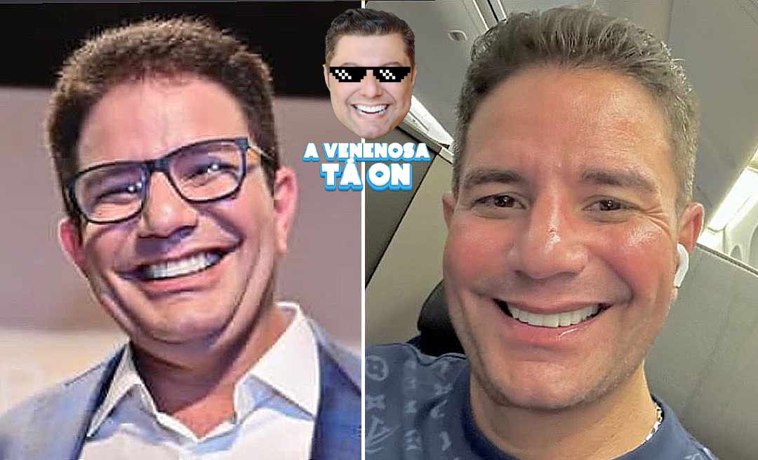 Governador Gladson Cameli exibe resultado de harmonização facial e resultado surpreende: ‘ficou muito bom’;  confira o antes e depois