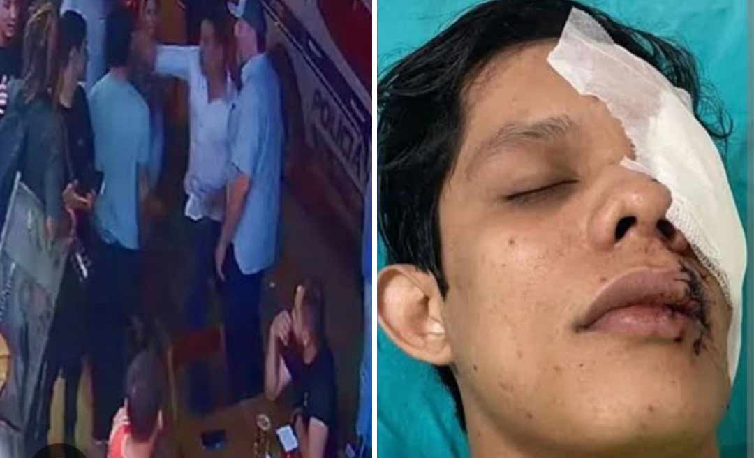 Ministério Público do Acre solicita prisão preventiva de empresário acusado de agredir jovem e causar perda de visão