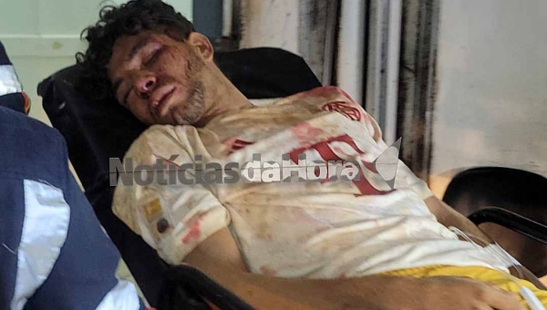 Morador de rua é espancado e tem nariz fraturado após ser acusado de furto