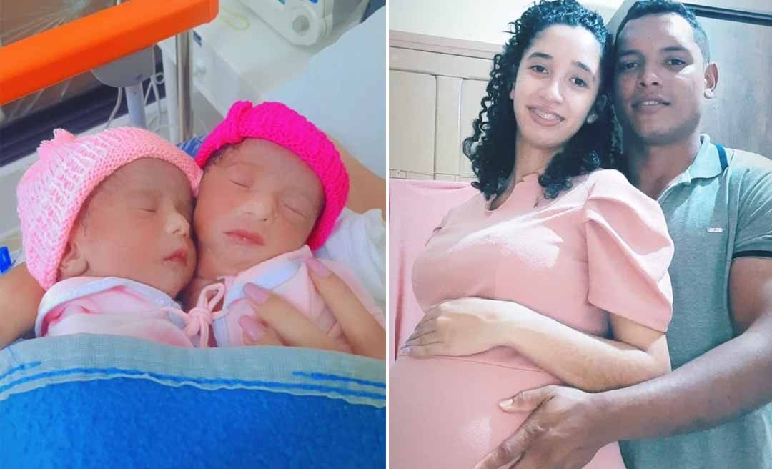 Gêmeas Siamesas Allana e Aylla morrem em Brasília; recém-nascidas dividiam mesmo coração