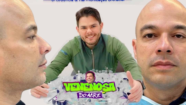 Detentor do posto de 'solteiro mais cobiçado do Acre', Dr. Marcos Santana (ex de Juh Vellegas) faz procedimento estético e arranca elogios da internet