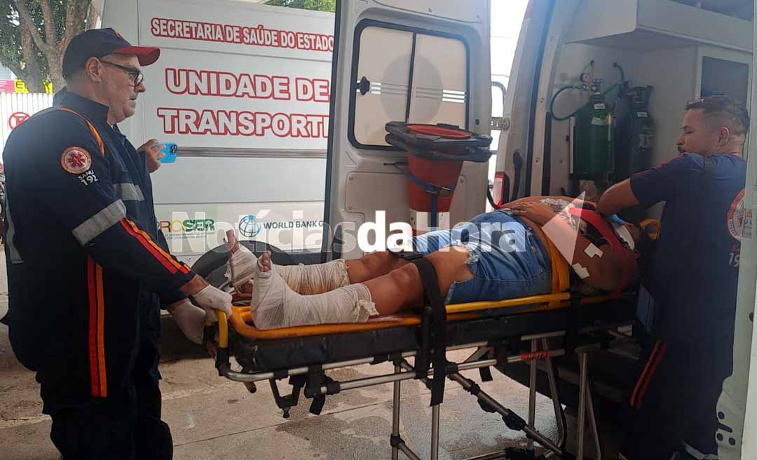 Colisão entre carro e moto na Estação Experimental deixa mulher com fratura exposta; vítima levava a filha para escola