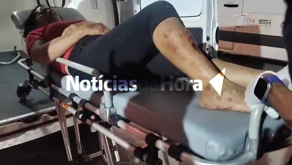 Falta de sinalização na BR-317 causa acidente grave; mulher fica ferida após colidir contra trator estacionado