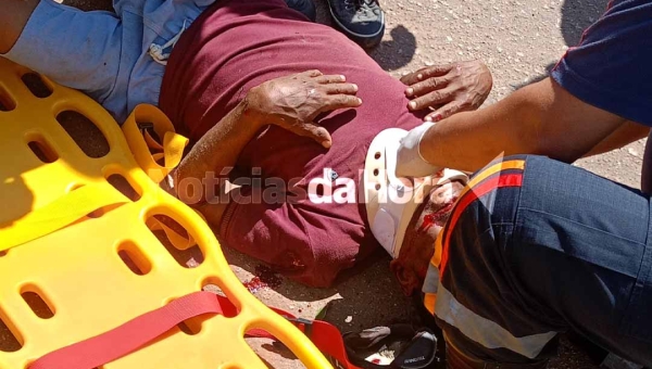 Ciclista fica gravemente ferido após queda na Baixada da Sobral; vítima apresentava sinais de embriaguez
