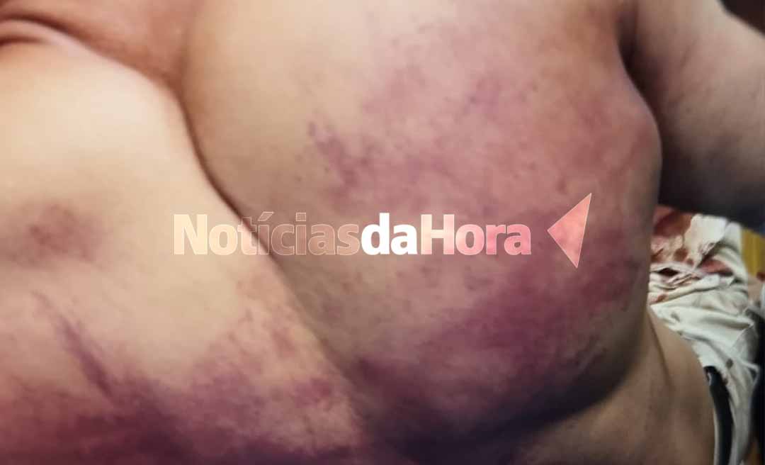 Homem é brutalmente agredido a ripadas na Baixada do Sobral, em Rio Branco