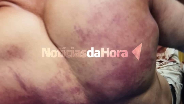 Homem é brutalmente agredido a ripadas na Baixada do Sobral, em Rio Branco