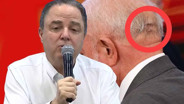 Médico de Lula descarta sequela e diz que função cerebral está intacta