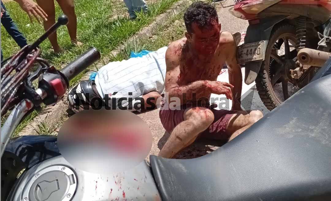 Colisão entre motos deixa três feridos na BR-317, próximo a Brasiléia