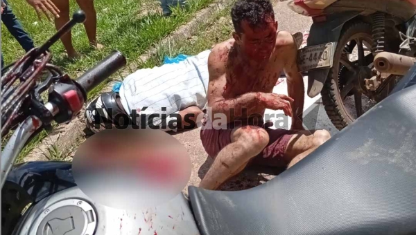 Colisão entre motos deixa três feridos na BR-317, próximo a Brasiléia