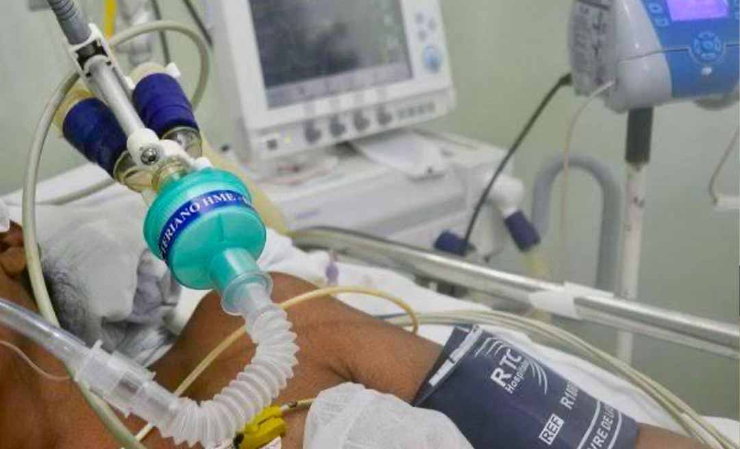 Aumenta os casos de SRAG ligados à Covid-19 no Brasil com destaque negativo para o Acre, aponta Fiocruz