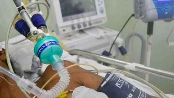 Aumenta os casos de SRAG ligados à Covid-19 no Brasil com destaque negativo para o Acre, aponta Fiocruz